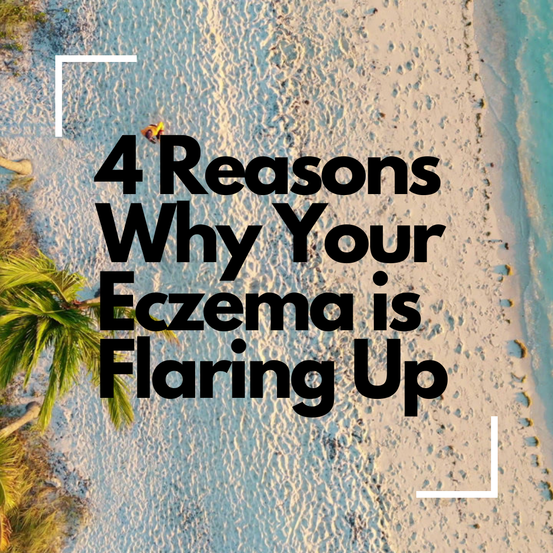 4 Reasons Why Your Eczema is Flaring Up