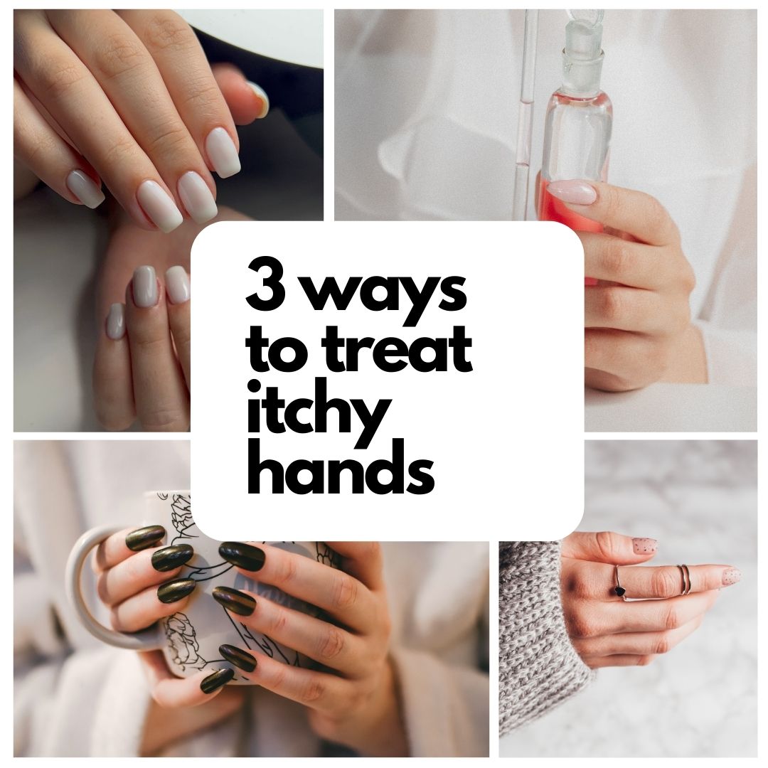 3 Ways to Treat Itchy Hands | Teddy's Eczema Bar
